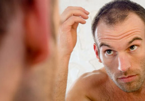 Causes of hair loss